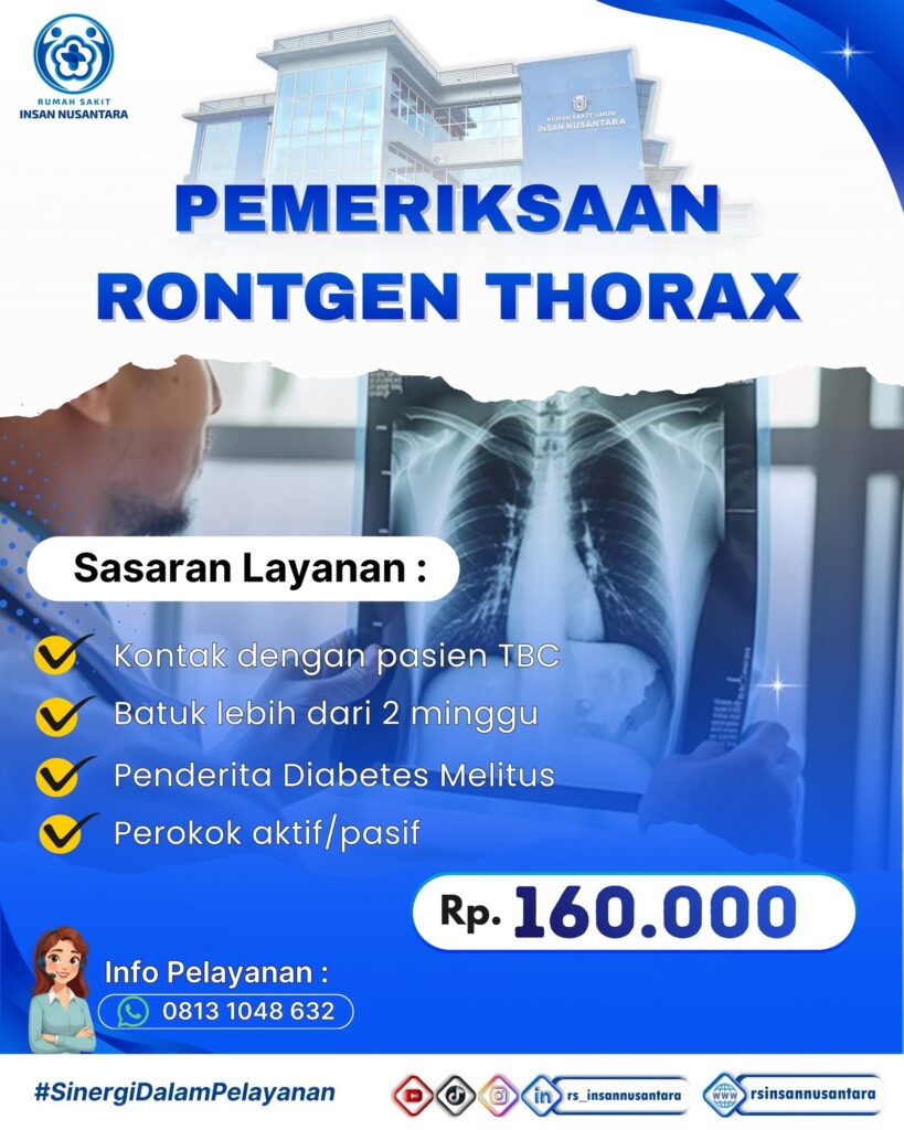 Poster Promo Rontgen